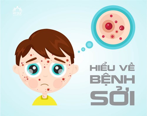 Tuyên truyền phòng chống dịch bệnh sởi