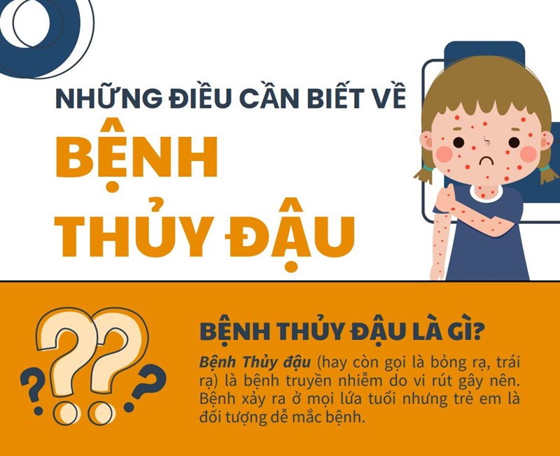 Những điều cần biết về bệnh thủy đậu