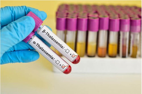 Bệnh Thalassemia