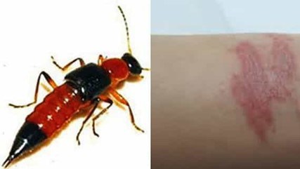 Độc tố của Kiến ba khoang