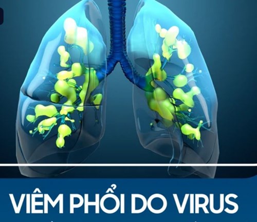 Triệu chứng và một số biện pháp phòng ngừa bệnh viêm phổi do virus