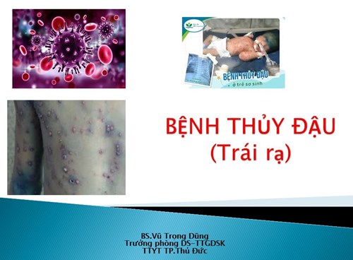 Tuyên truyền về phòng, chống bệnh thủy đậu