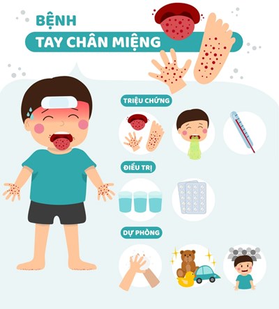 Bệnh tay chân miệng: Các biện pháp phòng ngừa